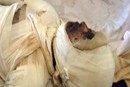 Self-immolation Survivor
