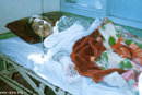 Self-immolation Survivor