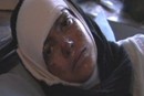 Self-immolation Survivor