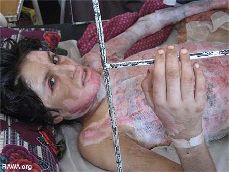 Self-Burning Among Afghan Women