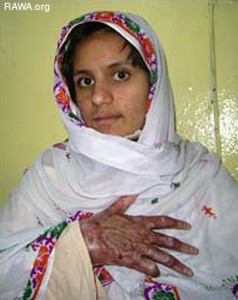 Self-Burning Among Afghan Women