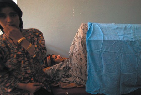 Self-Burning Among Afghan Women