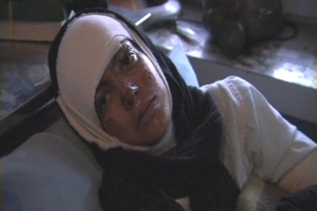 Self-Burning Among Afghan Women
